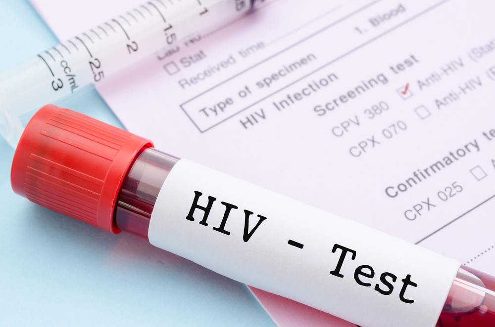 kako prenašati HIV