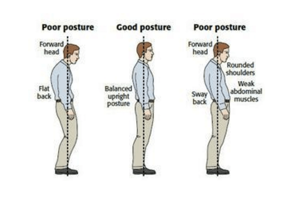 Vir slike: http://www.thephysiocompany.com/blog/stop-slouching-postural-dysfunction-symptoms-causes-and-treatment-of-bad-posture