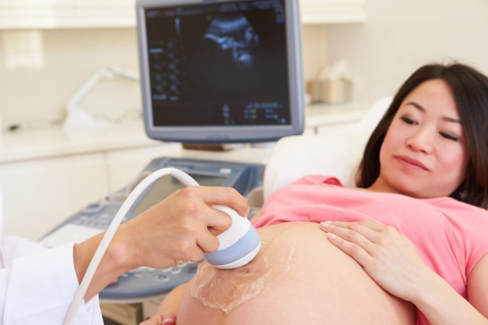 Ultrazvok nosečnosti