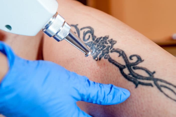 nevarnost tetoviranja