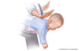 Koraki za pomoč pri zadušitvi dojenčkov (1-3): www.webmd.com