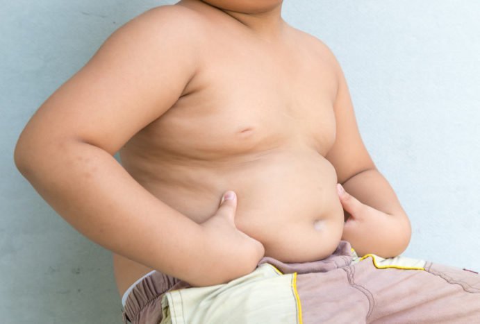 debelost pri otrocih