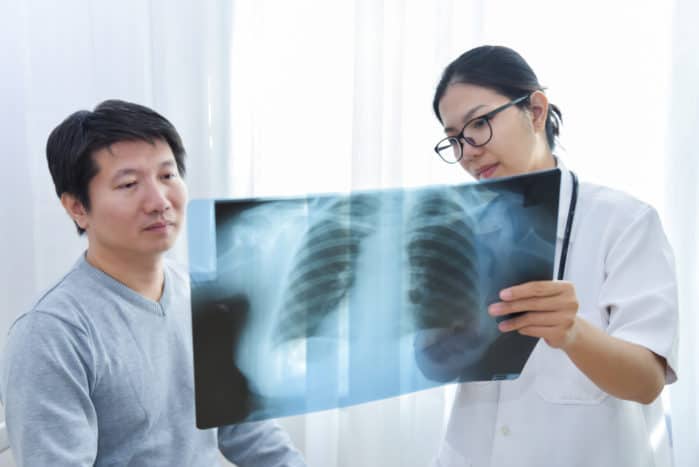 intersticijske pljučne bolezni