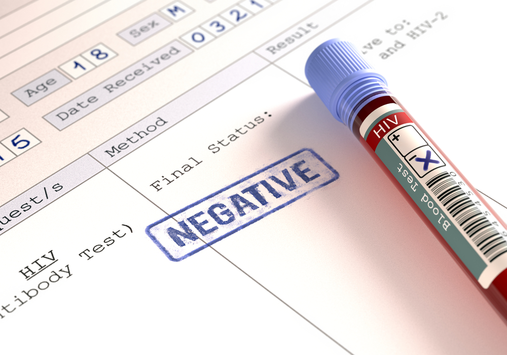 pomen rezultatov negativnega testa na HIV