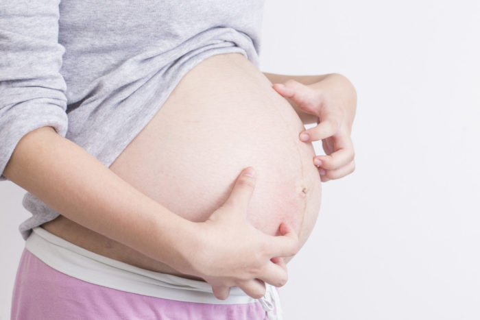 Pruritski folikulitis je vzrok srbeče kože med nosečnostjo