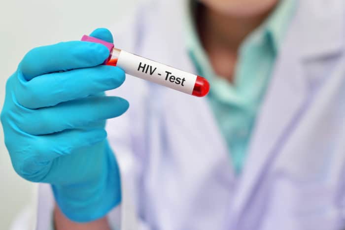 HIV test krvi